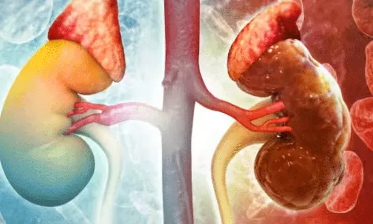 Kidney Failure Symptoms: కిడ్నీ వైఫల్యానికి తొలి సంకేతాలు.. వీటిని అస్సలు విస్మరించకండి.