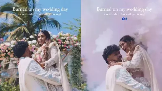 Photo Shoot: ఫొటోషూట్‌లో కలర్ బాంబ్ పేలి ఆసుపత్రి పాలైన వధువు