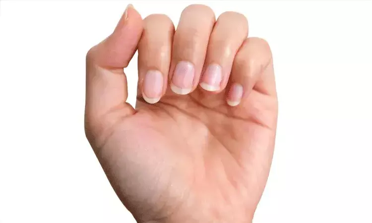 గోళ్లలో కనిపించే చిన్న మార్పులు.. కాలేయ ఆరోగ్యానికి సంకేతాలు