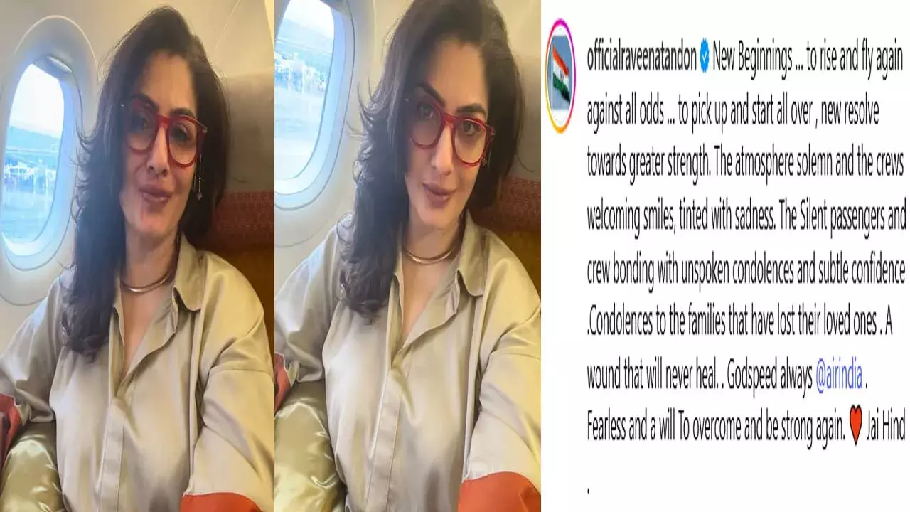 Actress Raveena Tandon : మర్చిపోలేని గాయమది.. రవీనా ఎమోషనల్ Actress Raveena Tandon : మర్చిపోలేని గాయమది.. రవీనా ఎమోషనల్