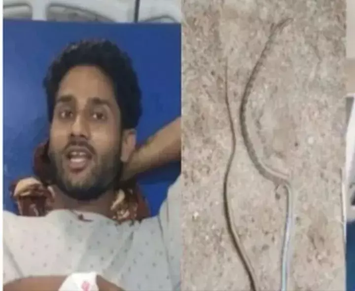 MIRACLE: మనిషిని కాటేసి చనిపోయిన పాము MIRACLE: మనిషిని కాటేసి చనిపోయిన పాము