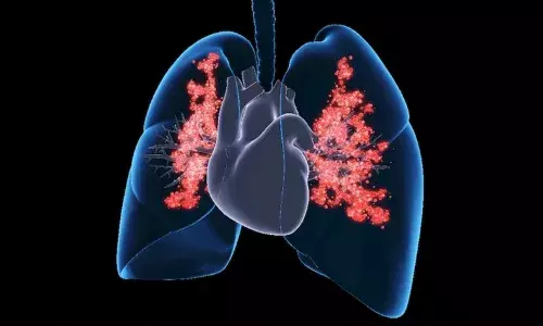 ఢిల్లీలోని ప్రతి 3 యువకులలో ఒకరికి తీవ్రమైన ఊపిరితిత్తుల వ్యాధి..