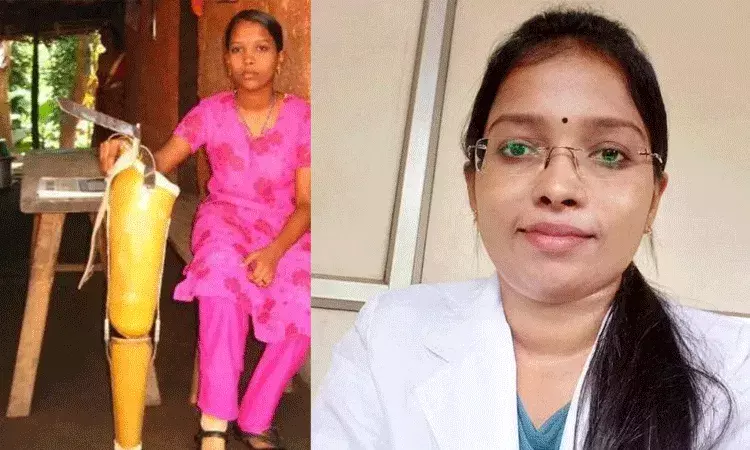 బాంబు పేలుడులో కాలు కోల్పోయినా.. కంటి డాక్టర్ గా మారిన అస్నా బాంబు పేలుడులో కాలు కోల్పోయినా.. కంటి డాక్టర్ గా మారిన అస్నా