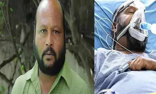 Actor Fish Venkat : ఫిష్ వెంకట్ మృతి.. ప్రముఖుల సంతాపం
