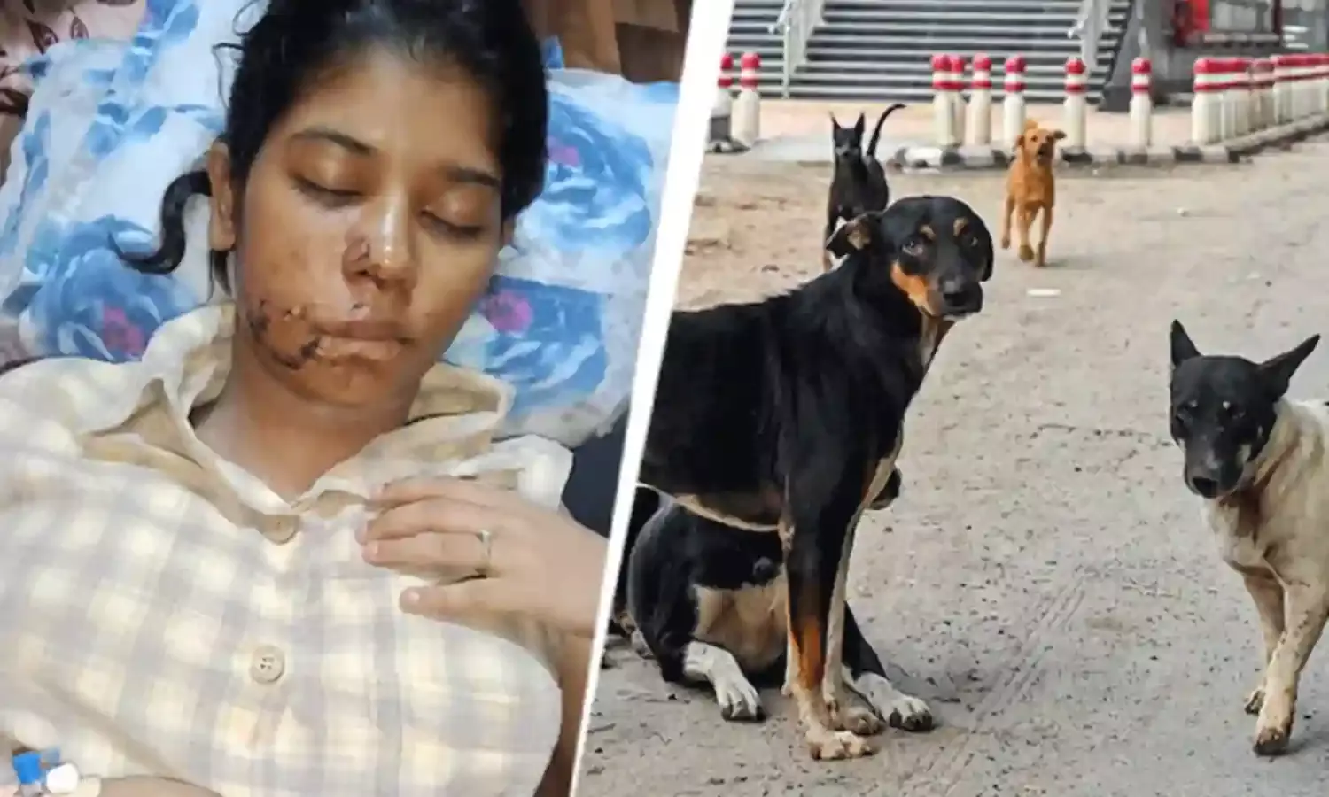 Kanpur: విద్యార్థినిపై వీధి కుక్కల దాడి.. ముఖంపై 17 కుట్లు Kanpur: విద్యార్థినిపై వీధి కుక్కల దాడి.. ముఖంపై 17 కుట్లు