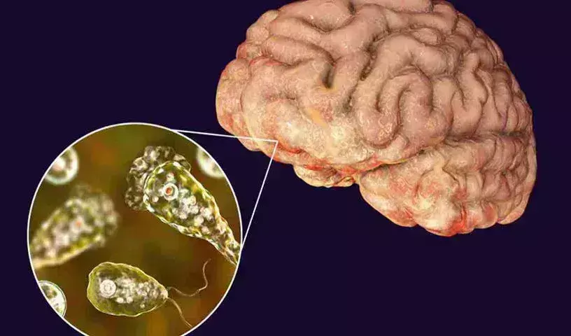 Brain Eating Amoeba : మెదడును తినే అమీబాతో కేరళలో ఐదవ మృతి Brain Eating Amoeba : మెదడును తినే అమీబాతో కేరళలో ఐదవ మృతి