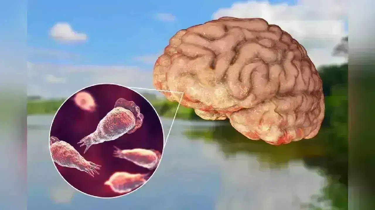 Brain-Eating Amoeba: ‘‘మెదడు తినే అమీబా’’ కేరళలో 19 మందిని చంపేసింది Brain-Eating Amoeba: ‘‘మెదడు తినే అమీబా’’ కేరళలో 19 మందిని చంపేసింది