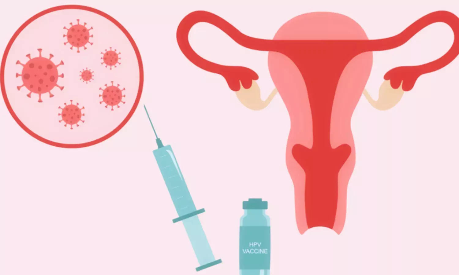 HPV పాజిటివ్.. క్రమం తప్పకుండా స్క్రీనింగ్, టీకాలు.. HPV పాజిటివ్.. క్రమం తప్పకుండా స్క్రీనింగ్, టీకాలు..