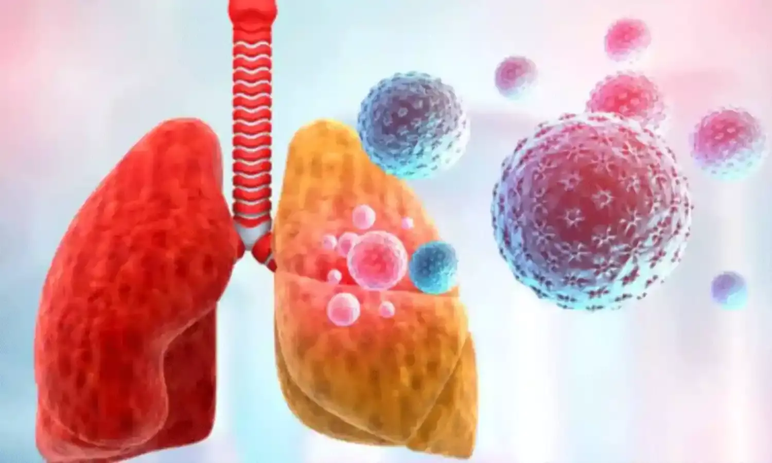 Health News: గాలి కాలుష్యంతో న్యుమోనియా .. విస్మరించకూడని ప్రారంభ సంకేతాలు.. Health News: గాలి కాలుష్యంతో న్యుమోనియా .. విస్మరించకూడని ప్రారంభ సంకేతాలు..