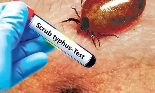 AP: ఏపీ ప్రజలను వణికిస్తున్న స్క్రబ్ టైఫస్